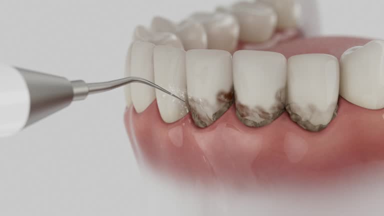Trusted Dental Crowns And Bridges service in Stevensville, MD - Dentist Open Now